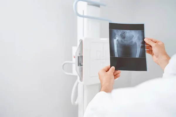 Digital X Ray